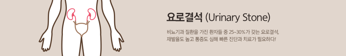 요로결석 (Urinary Stone) - 비뇨기과 질환을 가진 환자들 중 25~30%가 갖는 요로결석, 재발율도 높고 통증도 심해 빠른 진단과 치료가 필요하다!